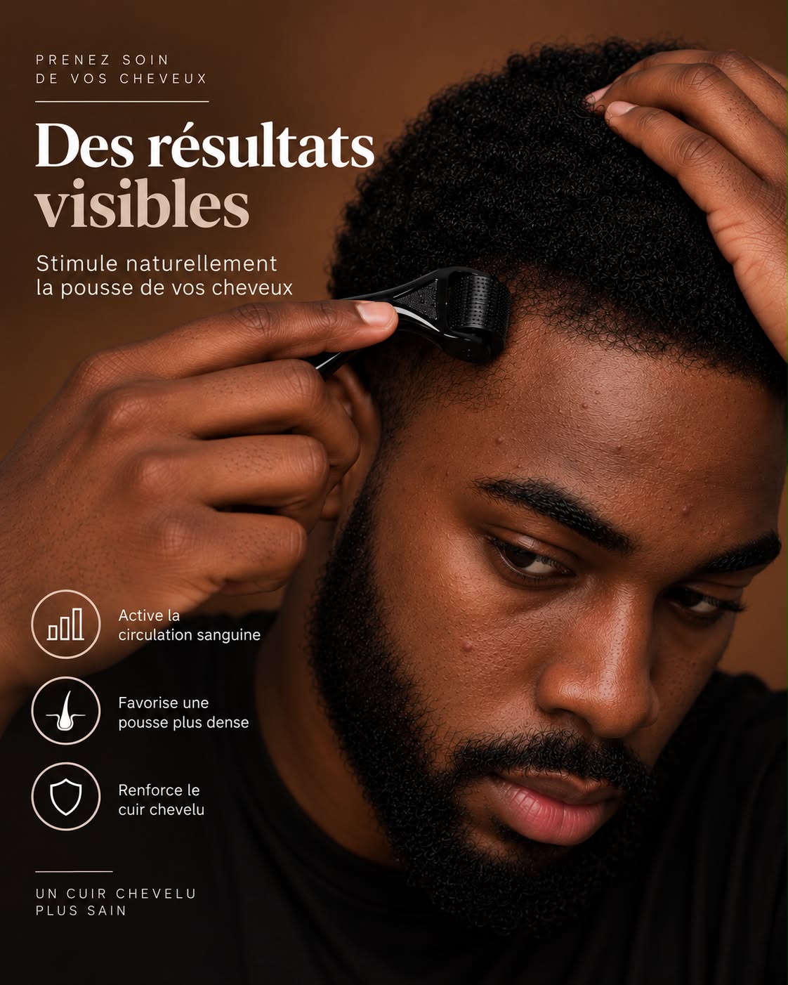 Dermaroller 540 micro-aiguilles – photo 2